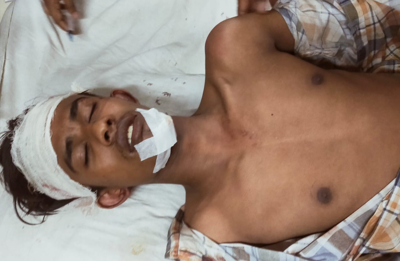 কোম্পানীগঞ্জে আ.লীগ-বিএনপির পাল্টাপাল্টি হামলা,আহত বিএনপির ৪ নেতাকর্মি