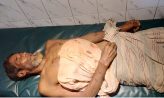 ঘর নির্মাণকে কেন্দ্র করে বিরোধ: ভাগিনার ধাক্কায় বুকে রড ঢুকে মামার মৃত্যু