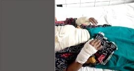 বেগমগঞ্জে যৌতুকের জন্য গৃহবধূকে পুড়িয়ে হত্যার চেষ্টা