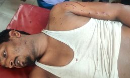 বেগমগঞ্জে ইয়াবা সেবন নিয়ে বিরোধের জেন ধরে অটোরিকশা চালক গুলিবিদ্ধ
