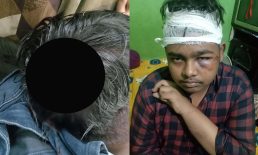 কিশোর গ্যাংয়ের হামলায় স্কুল ছাত্রের গুরুতর অবস্থা, অভিযোগের ৫ দিনেও কোন তৎপরতা নেই