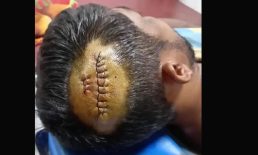 আন্ডারচরে কুড়ালের কোপে কৃষকের মৃত্যু