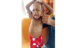 শিশু সাদিয়াকে বাঁচাতে এগিয়ে আসুন