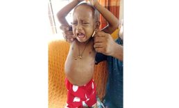 শিশু সাদিয়াকে বাঁচাতে এগিয়ে আসুন