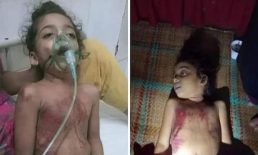 চাটখিলে অটোরিকশার চাকায় পিষ্ট হয়ে শিশুর মৃত্যু