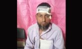 মাইজদীতে আদালত প্রাঙ্গনে বাদীর উপর হামলা, আহত ১