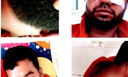 সুবর্ণচরে দিনমজুরের উপর দুর্বৃত্তদের হামলা দিনমজুর গুরুতর আহত