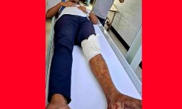 বেগমগঞ্জে ছাত্রদল নেতার হাঁটুতে অস্ত্র ঠেকিয়ে গুলি