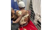 জেলা পরিষদের সাবেক সদস্যকে কুপিয়ে জখম