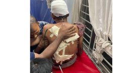 জেলা পরিষদের সাবেক সদস্যকে কুপিয়ে জখম