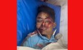 সেনবাগের মোটরসাইকেল-ট্রাকের সংঘর্ষ দুই মোটরসাইকেল আরোহী নিহত ,আহত- 1