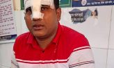 সেনবাগে বড় ভাইয়ের ধারালো অস্ত্রের আঘাতে ছোট ভাই আহত
