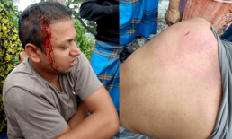 সোনাইমুড়ীতে সন্ত্রাসী হামলায় দুই নারীসহ আহত তিন