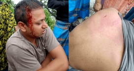 সোনাইমুড়ীতে সন্ত্রাসী হামলায় দুই নারীসহ আহত তিন