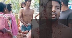 চাটখিলে মাছ ধরতে গিয়ে সন্ত্রাসী হামলার শিকার জামাল