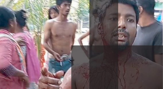 চাটখিলে মাছ ধরতে গিয়ে সন্ত্রাসী হামলার শিকার জামাল