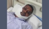কোম্পানীগঞ্জে সাবেক বিএনপি নেতা ও তার ভাইকে কুপিয়ে হত্যাচেষ্টা