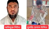 চাটখিলে নামাজরত মুসল্লিকে পিটিয়ে রক্তাক্ত করেছে আওয়ামীলীগ নেতা