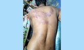 হাতিয়ায় চাঁদা না পেয়ে ব্যবসায়ীকে পিটিয়ে রক্তাক্ত করার অভিযোগ