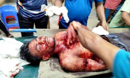বেগমগঞ্জে কিশোরকে নৃশংসভাবে কুপিয়ে হত্যা