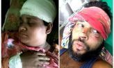 কোম্পানীগঞ্জে মেয়েকে কুপ্রস্তাবের প্রতিবাদ করায় মা-বাবাকে কুপিয়ে জখম