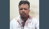 কোম্পানীগঞ্জে জমি নিয়ে বিরোধের জেরে চাচার মাথা ফাটিয়ে দিল ভাতিজা
