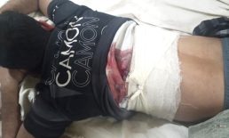 দাদপুরে ব্যবসায়ীকে গুলি করে মোটরসাইকেল ছিনতাই