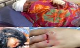 মাইজদী সদর হাসপাতাল রোডে চাপাতির কোপে আহত ২