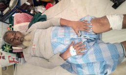 কোম্পানীগঞ্জ দুই গ্রুপের সংঘর্ষে সাবেক চেয়ারম্যানসহ আহত – ১০