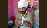 কবিরহাটে কৃষকের হাত ভেঙে কুপিয়ে জখম