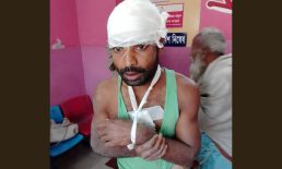 কবিরহাটে কৃষকের হাত ভেঙে কুপিয়ে জখম