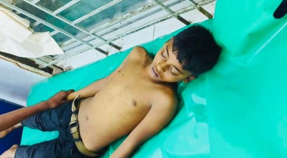 কোম্পানীগঞ্জে পুকুরে গোসল করতে নেমে কিশোরের মৃত্যু