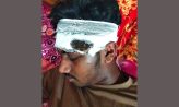 কোম্পানীগঞ্জে চলাচলের রাস্তা দখল নিয়ে মা-ছেলেকে কুপিয়ে জখম