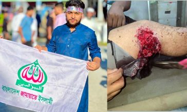 বেগমগঞ্জে বাড়ির সামনে জামায়াত কর্মী গুলিবিদ্ধ