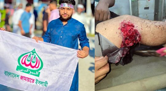 বেগমগঞ্জে বাড়ির সামনে জামায়াত কর্মী গুলিবিদ্ধ