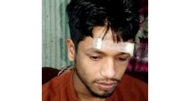 চাটখিলে প্রকাশ্যে মাদক বিক্রিতে বাঁধা দেয়ায় স্থানীয় যুবকদের উপর হামলা
