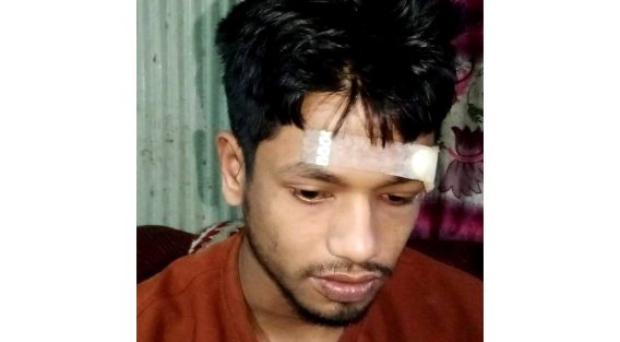 চাটখিলে প্রকাশ্যে মাদক বিক্রিতে বাঁধা দেয়ায় স্থানীয় যুবকদের উপর হামলা