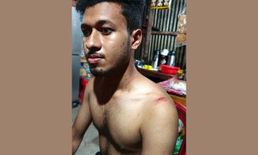 সুবর্ণচরে জমি দখলের চেষ্টা, বাধা দেওয়ায় বাবা ও ছেলের উপর সন্ত্রাসী হামলা