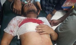 বেগমগঞ্জে সন্ত্রাসী হামলায় যুবদলের নেতা নুর আলম গুরুতর আহত