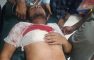 বেগমগঞ্জে সন্ত্রাসী হামলায় যুবদলের নেতা নুর আলম গুরুতর আহত
