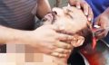 সোনাইমুড়ীতে জমি নিয়ে বিরোধে কুপিয়ে জখম, থানায় মামলা