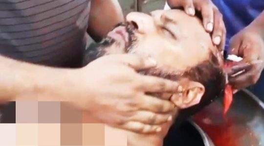 সোনাইমুড়ীতে জমি নিয়ে বিরোধে কুপিয়ে জখম, থানায় মামলা